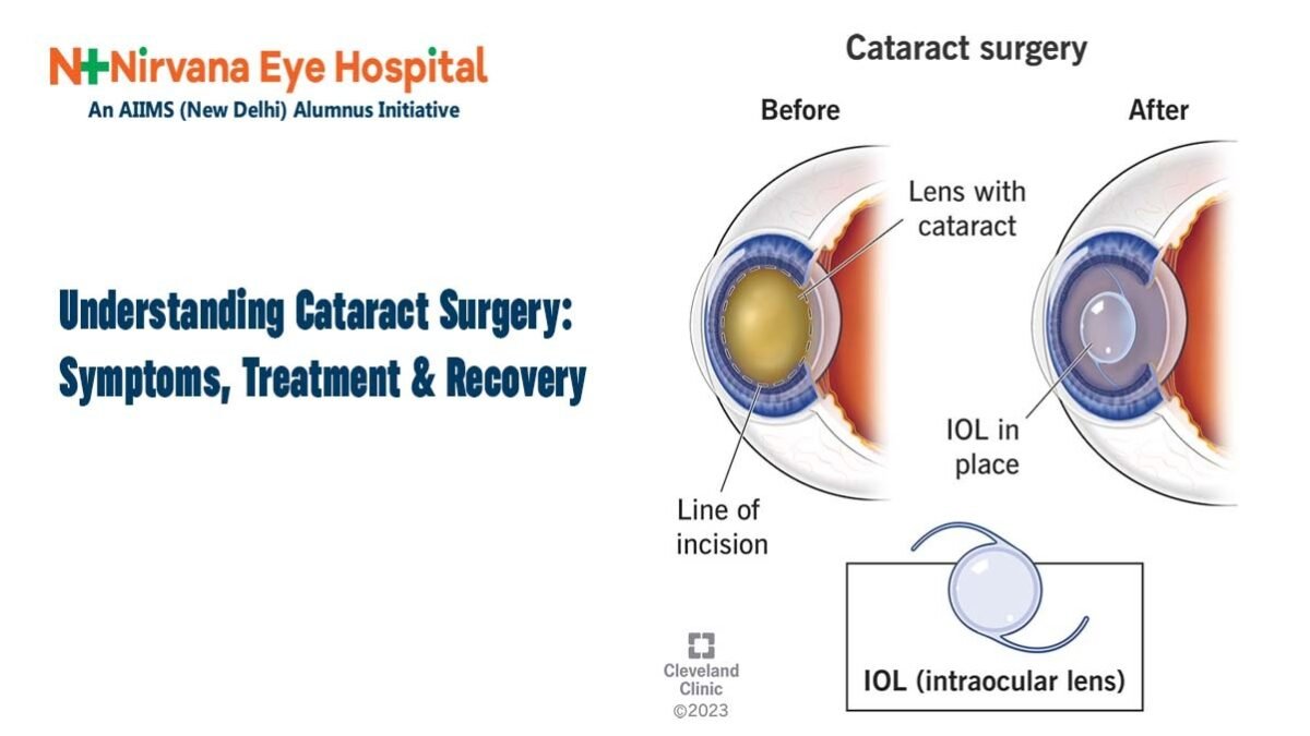 Eye hospital in Bhubaneswar